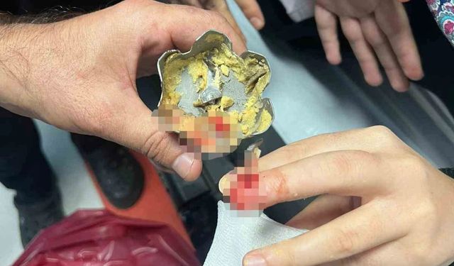 Batman'da korkutan kaza!